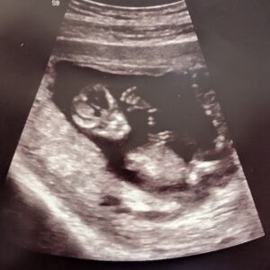 A photo of Blake Michael Clarence Daniel Swackhammer